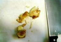 佛跳墙的做法 步骤11