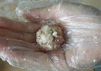 豆腐丸的做法 步骤7