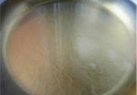 蜜三样的做法 步骤4