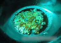 罗非鱼豆腐煲的做法 步骤8