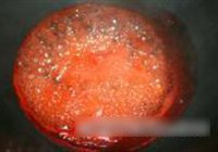 汁香糯米狮子头的做法 步骤12