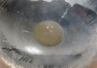 ˵ 2