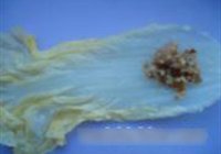 白菜银丝卷的做法 步骤10