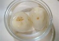 鱼香炒薯条的做法 步骤1